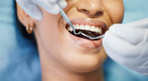 Best Cracked Tooth Emergency Dentist  in Golden, CO