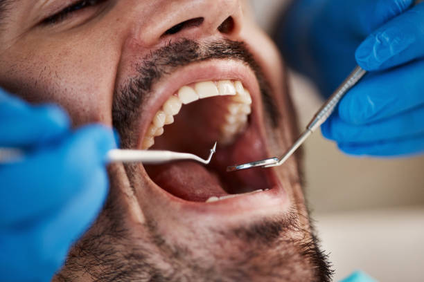 Best Dentist for Tooth Abscess  in Golden, CO