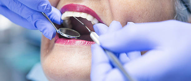 Urgent Tooth Repair in CO